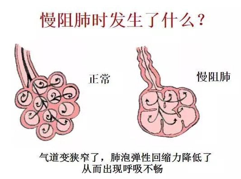 哮喘专科医院：守护呼吸健康的前沿防线