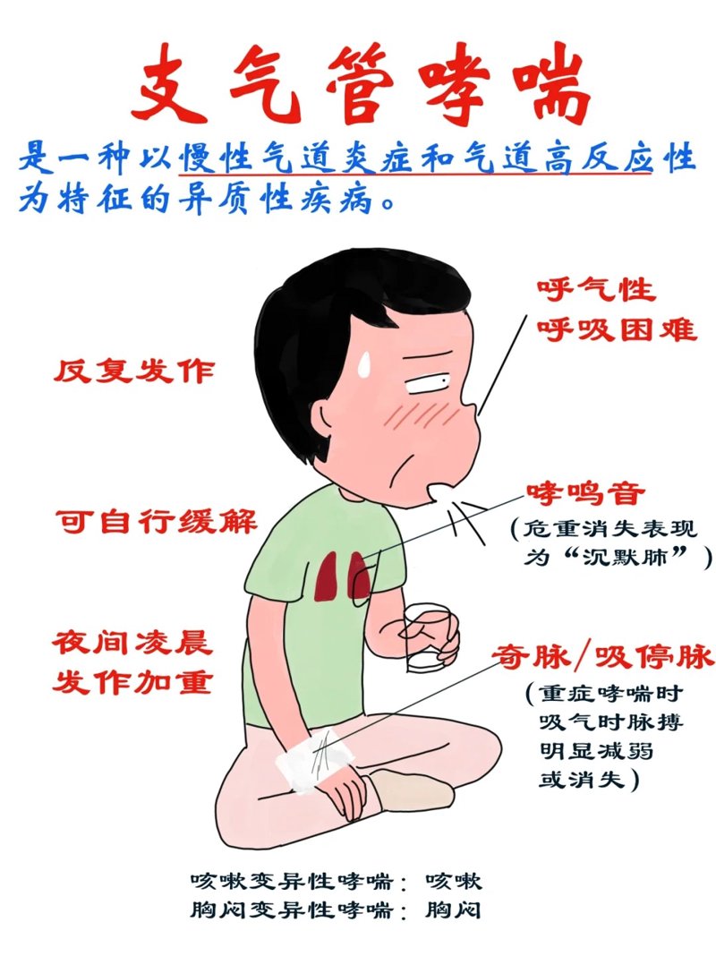咳嗽变异性哮喘