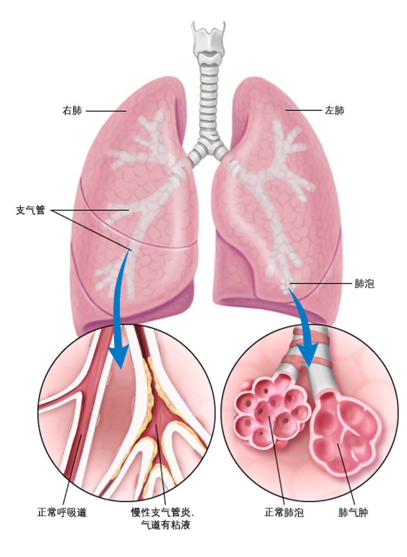 探索济南哮喘病医院：呼吸健康守护者